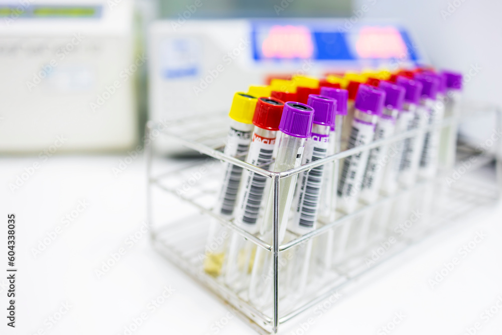 Medical blood tube on white table in hospital.Colorful tube with blur background.Medical analysis device technology in blood bank for donation.Science or scientist concept.Stainless rack. Medical blood tube on white table in hospital.Colorful tube with blur background.Medical analysis device technology in blood bank for donation.Science or scientist concept.Stainless rack.