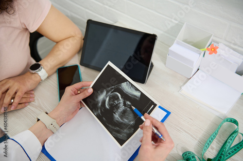 Top view hands of doctor of ultrasound diagnostics, obstetrician gynecologist, holding ultrasound scan, explaining to pregnant woman the development of сhild in womb. Planned ultrasound 2nd trimester