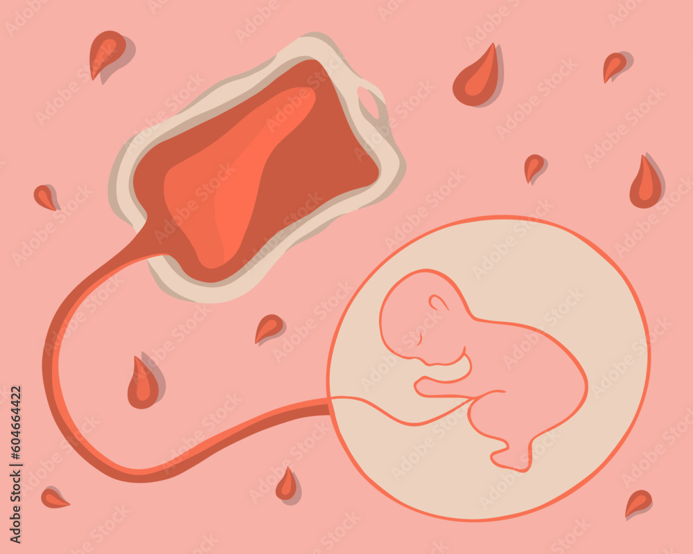 Vector isolated illustration of umbilical cord blood. Stem cells. Freezing stem cells. Collection of umbilical cord blood.