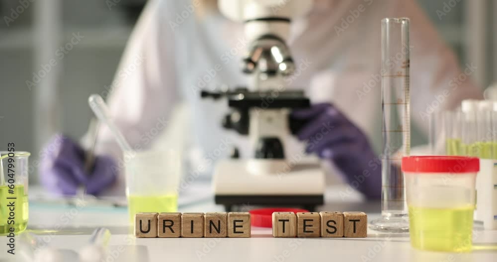 Scientist analyzes urinalysis using microscope in laboratory. Clinical