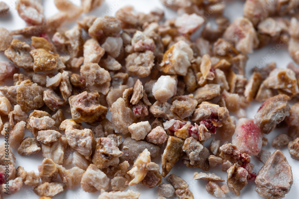 Kidney stones. Stones were removed from the patient's kidneys Kidney stones. Stones were removed from the patient's kidneys