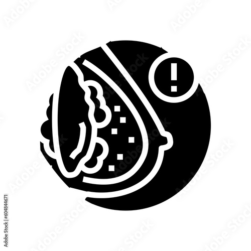 Cuadro en lienzo capsular contracture surgery glyph icon vector