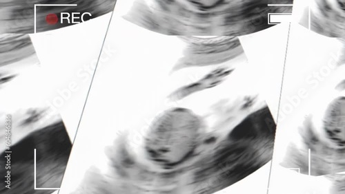 Recording a mother's womb ultrasound during pregnancy. Ultrasound of a fetus at 12 weeks photo