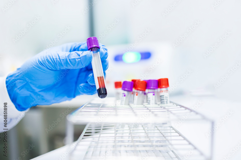 Hand of scientist or laboratory technician with blue medical glove inside lab room in hospital or clinic.Blood tube in blood donation bank for patient.Blood group matching analysis technology. Hand of scientist or laboratory technician with blue medical glove inside lab room in hospital or clinic.Blood tube in blood donation bank for patient.Blood group matching analysis technology.