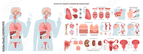 Diagram about health effect of cigarette smoking. Illustration about risk of smokers.