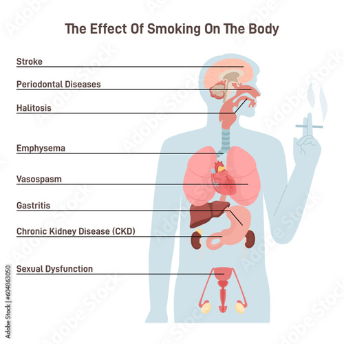 Diagram about health effect of cigarette smoking. Illustration about risk of smokers.