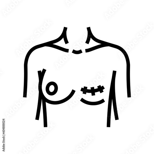 mastectomy surgery surgery line icon vector. mastectomy surgery surgery sign. isolated contour symbol black illustration