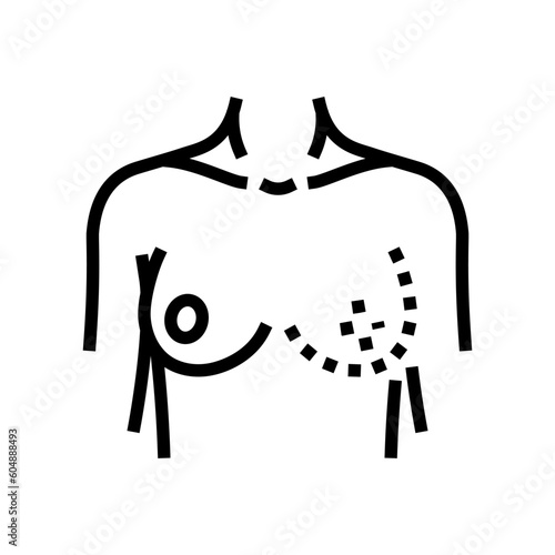 breast reconstruction surgery line icon vector. breast reconstruction surgery sign. isolated contour symbol black illustration