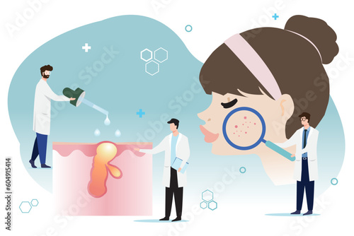 The dermatologists diagnose and treat woman skin vector on white background. The other one is holding magnifying glass, enlarged acne on skin and the other drop medicine on acne. Skin care concept.