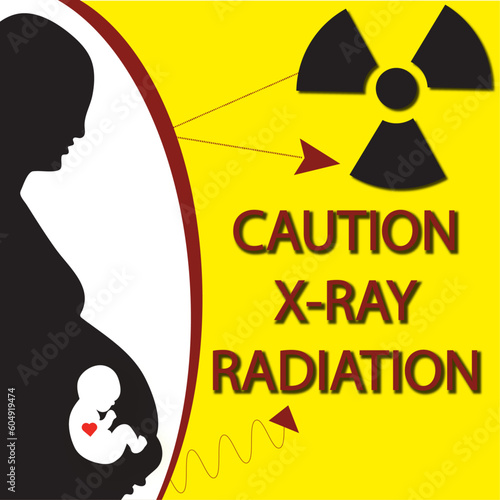 radiation hazard symbol, pregnant woman warning, caution x-ray radiation