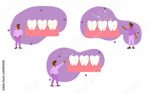 dental care illustration set. characters have dirty on teeth. they use a dental floss to clean and whiten teeth. cleaning teeth by dental floss concept. vector illustration.