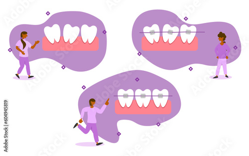 dental care illustration set. characters have dental problems, including crooked, gapped, rotated or crowded teeth. dentist starts braces so that teeth are normal. dental orthodontic concept.