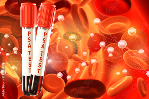 PSA test. Flasks near blood...