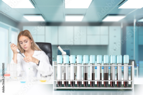 Blood analysis. Test tubes ...
