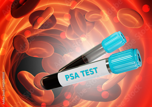 Blood tubes. Samples of PSA...