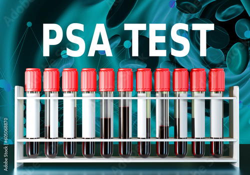 PSA test. Set of flasks for...