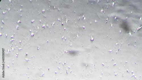 Large number of immobile spermatozoa under microscope magnified 400 times in oblique illumination. Bad spermogram of male semen. Problems with conception of child and male reproductive system. photo