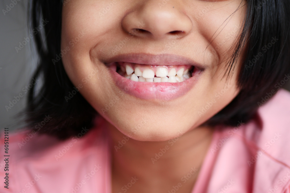 child smiling with healthy white teeth. child smiling with healthy white teeth.