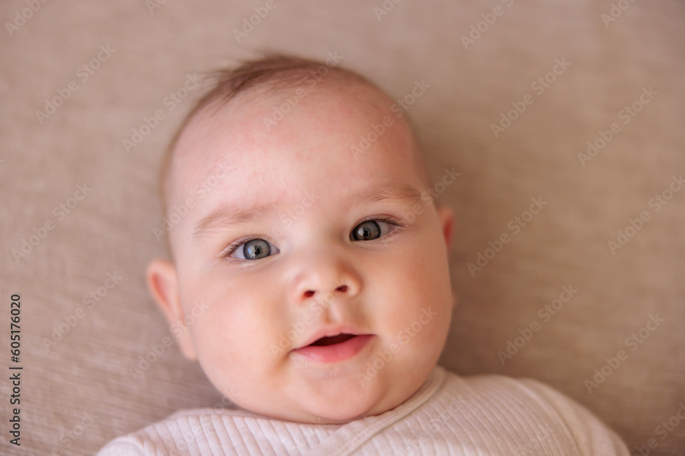 Portrait of baby boy with eczema rash on face skin