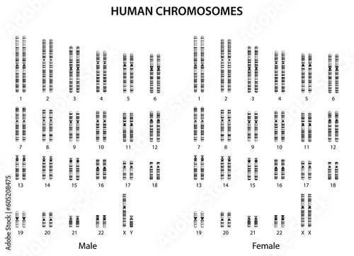 Human chromosomes (human normal karyotype). photo