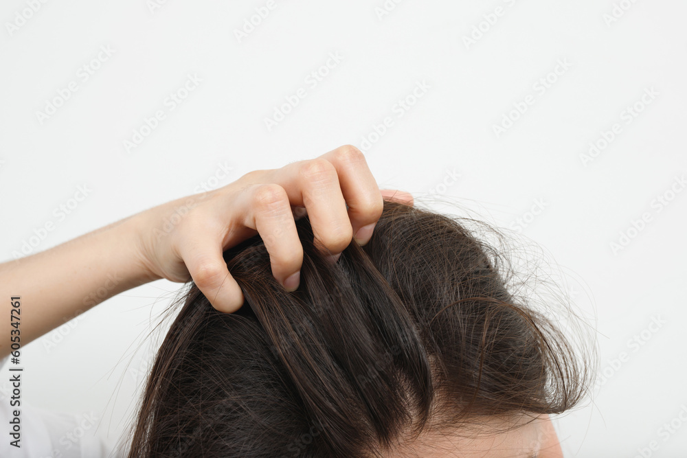 Obraz premium A woman has problems with hair and scalp,she has dandruff from allergic reactions to shampoos. and hair conditioner