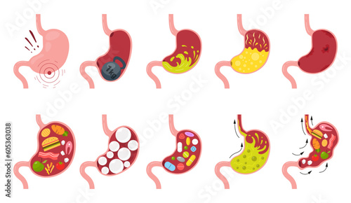 Stomach symptoms with pills heartburn gases ache heaviness bloating vomiting full set vector flat