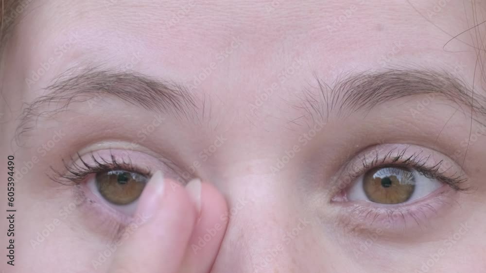 close up part of woman's face, girl 30 years old, human eyes, carefully examines wrinkles on face, skin condition, age-related skin changes, aesthetic injection cosmetology, care anti-aging close up part of woman's face, girl 30 years old, human eyes, carefully examines wrinkles on face, skin condition, age-related skin changes, aesthetic injection cosmetology, care anti-aging