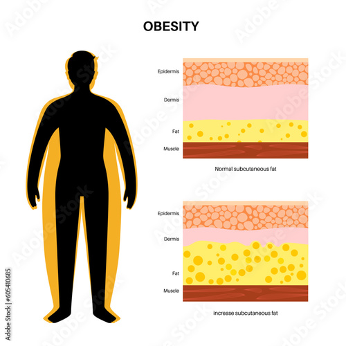 Obesity fat level