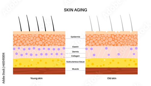 Skin aging poster