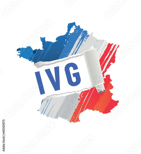 IVG - interruption volontaire de grossesse en France