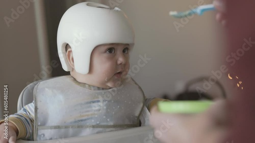 8 Month Old Baby Wearing Therapy Helmet In High Chair Being Fed and Excited for More. slow motion of an 8 month old in a high chair wearing a corrective therapy helmet and being fed then excited photo