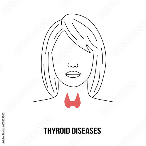 Woman with thyroid gland in linear style. Thyroid diseases, health care and medical concept. Ultrasound diagnosis of the thyroid gland. Front view icon. Vector illustration 
