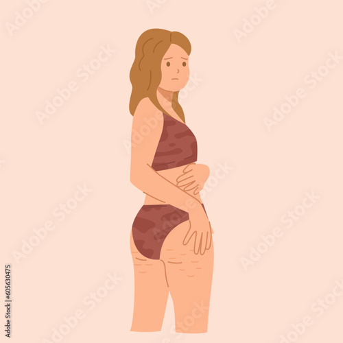 Young woman in underwear is upset because of cellulite on her buttocks.