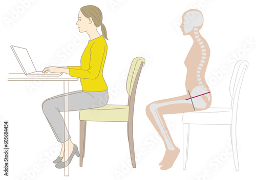 反り腰ででデスクワークする女性と骨格図