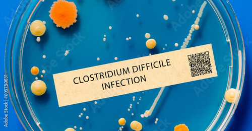 Clostridium difficile infection - Bacterial infection that can cause severe diarrhea and inflammation of the colon. photo