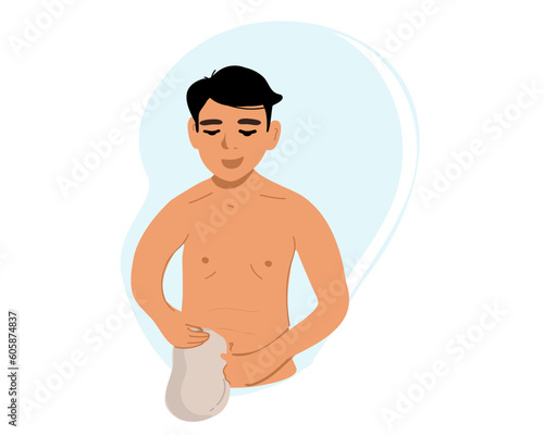 A man with a colostomy bag. Vector illustration photo