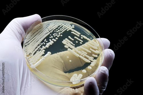 Hand of doctor or scientist showing a microbiological culture of the yeast Candida auris, responsible for urinary tract infections (UTIs) photo