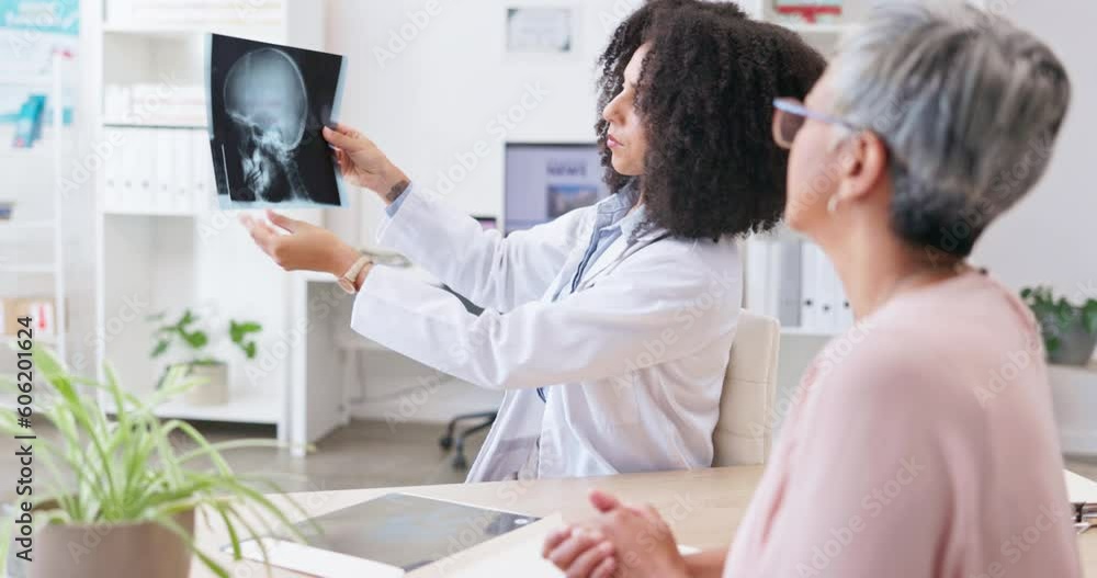 Woman, doctor check and senior woman with mri results in a hospital for brain and head injury. Talking, healthcare and medical worker with elderly female speaking about xray and treatment choice Woman, doctor check and senior woman with mri results in a hospital for brain and head injury. Talking, healthcare and medical worker with elderly female speaking about xray and treatment choice
