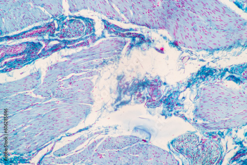 Showing Light micrograph of the Adrenal gland and Urinary bladder human under the microscope for education in the laboratory.