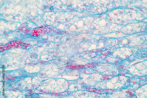 Showing Light micrograph of the Adrenal gland and Urinary bladder human under the microscope for education in the laboratory.