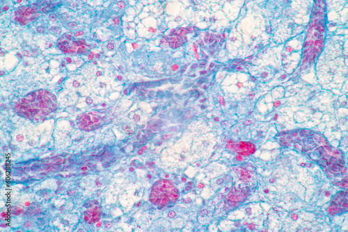 Showing Light micrograph of the Adrenal gland and Urinary bladder human under the microscope for education in the laboratory.