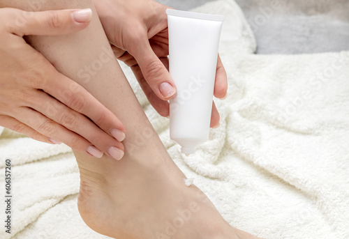 callus and corns woman foot feet consequence of wearing uncomfortable shoes.dermatologic disorders.cracked heels unkempt nails.girl applying cream red damaged skin.bathroom towel top side view.