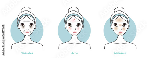 Skin problems set vector illustration isolated on white background. Infographic of cute woman with wrinkles, dark circles, acne, melasma and dark spots on face. Skin care and beauty concept.
