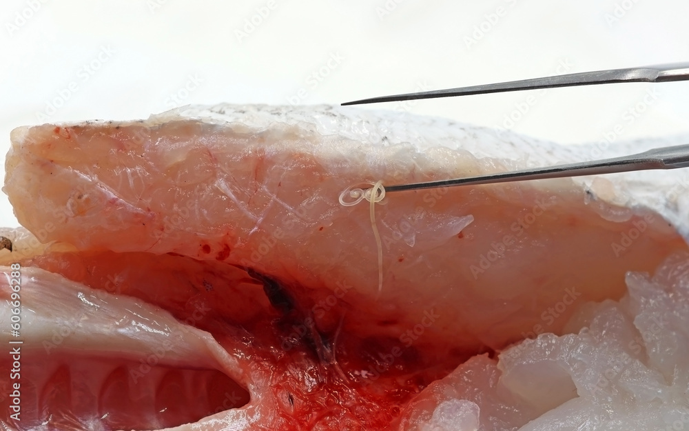Fototapeta premium Extraction of parasitic worms Anisakis from a fish