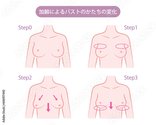 加齢によるバストのかたちの変化のイラスト