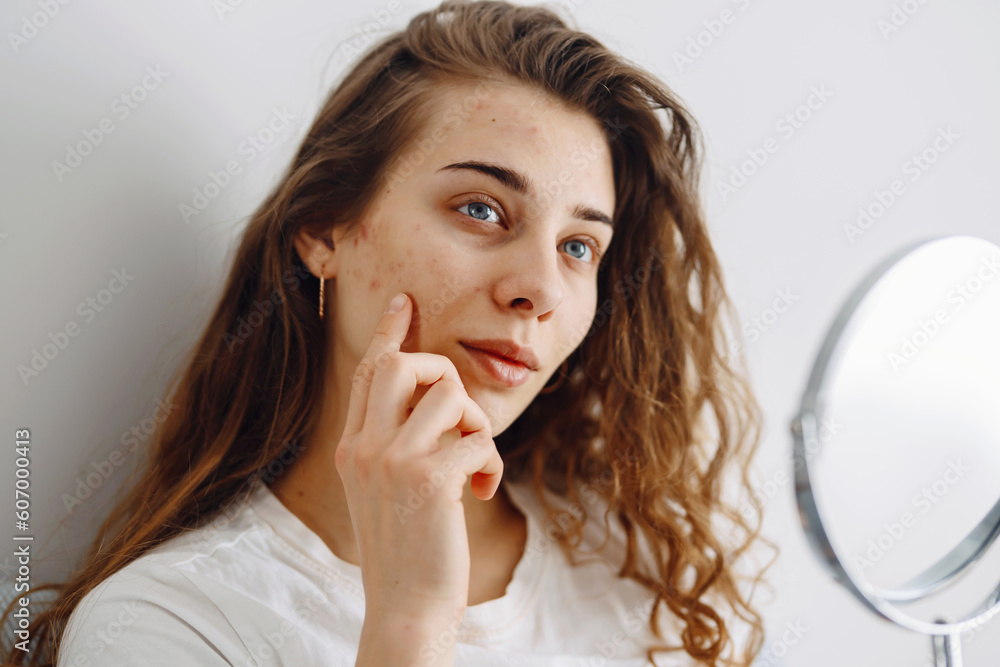 Beautiful woman with problem skin looking into mirror. Dermatology. Allergic reaction from cosmetic, red spot or rash on face. Beauty care from skin problem. Beautiful woman with problem skin looking into mirror. Dermatology. Allergic reaction from cosmetic, red spot or rash on face. Beauty care from skin problem.