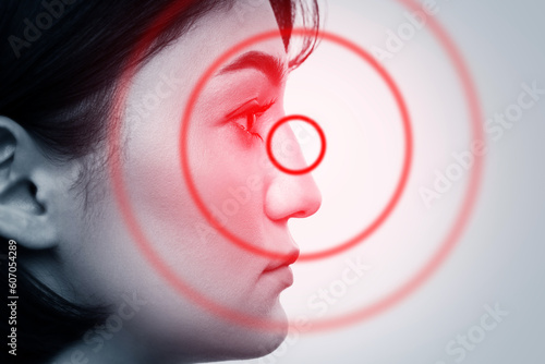 Photography Young upset woman with Nose and Sinus Disorders such as chronic rhinosinusitis o