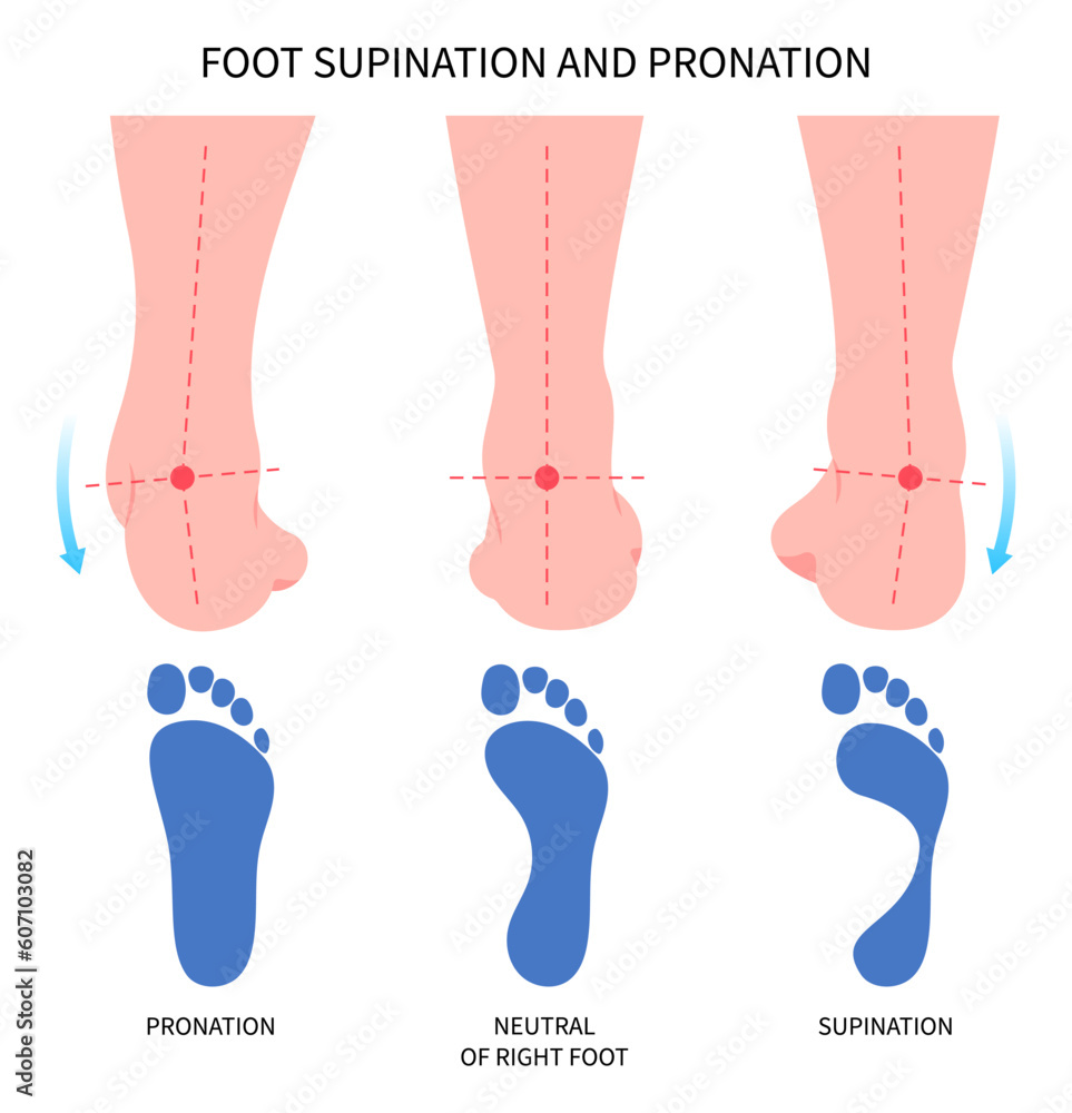 Pronation supination inward roll Feet over and Achilles Lower high