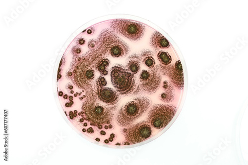A Petri dish with fungal colonies in the Microbiology laboratory.  photo