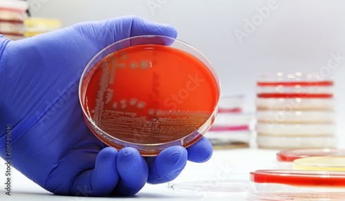 A microbiological culture Petri dish with a colonies of the pathogenic bacterium Escherichia coli (E. coli). photo